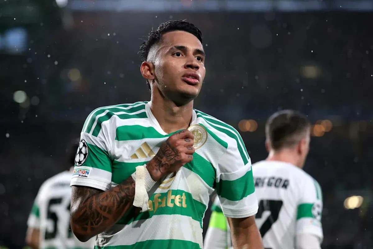Jugador de Celtic mostrando su camiseta durante el partido